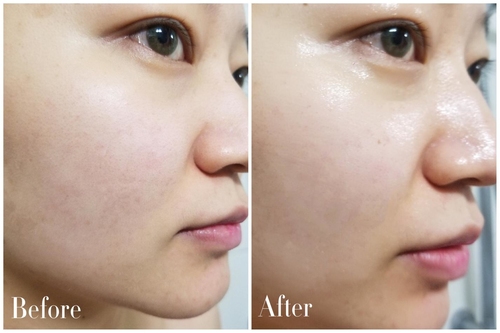 一张面膜让你皮肤好到爆,一片面膜能试出效果吗