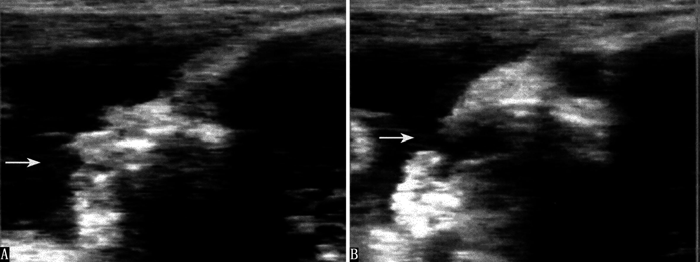 明明白白做超声（21）：胎儿发育生物物理学监测2-胎心活动及胎动