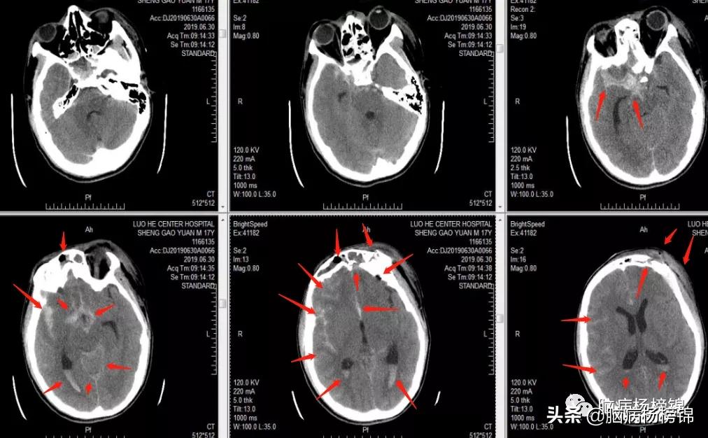 意外伤害很严重年纪轻轻难保命，谭院刀刀用真情豫南名医中中中