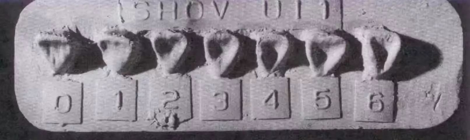 新生儿青色皮肤是不是胎记,新生儿青斑是中国人才有的吗