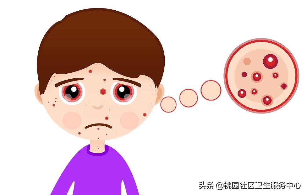 春天皮肤过敏泛红发痒小妙招,春天小孩出现皮肤过敏怎么办