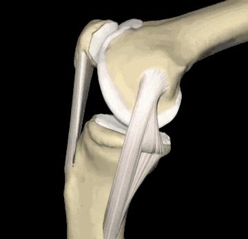 膝关节咔咔响隐隐作痛,下蹲时膝关节有小咔咔声