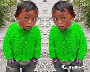 根据孕囊大小计算孕周,可以计算孕周的app