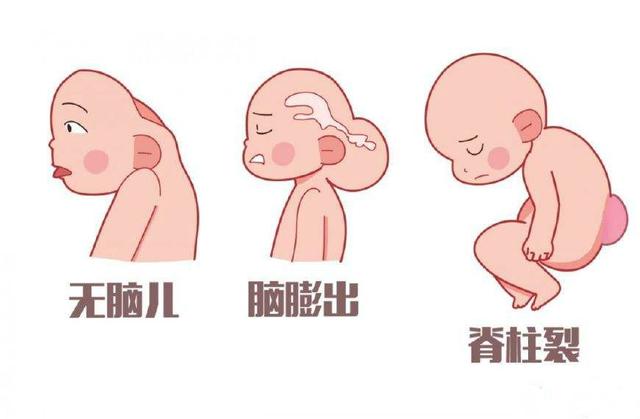 备孕补充叶酸片推荐什么牌子,备孕补充叶酸400还是800