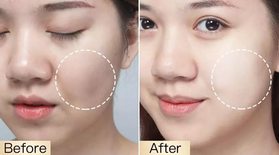 影后强势打Call！1片去浮肿、3周变紧致，大饼脸也有救了