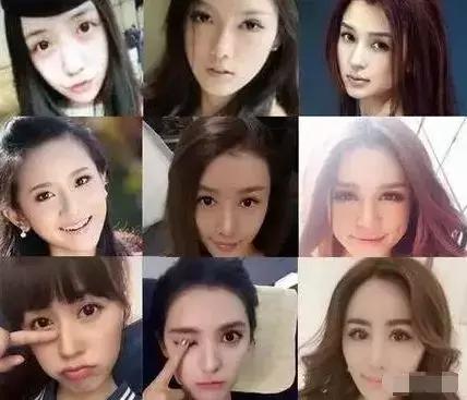 网红眼睛开眼角,做过开眼角的网红