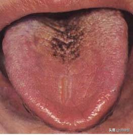 最实用的舌诊图六大舌象,舌诊深入学习书