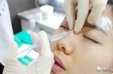 网红整鼻子整出坑,千万网红被坑