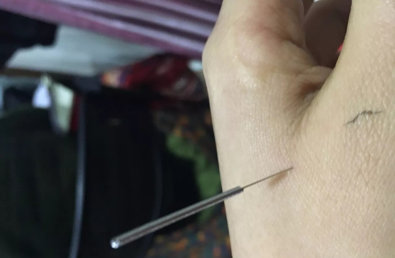 北京艾灸经络推拿培训,艾灸培训有感