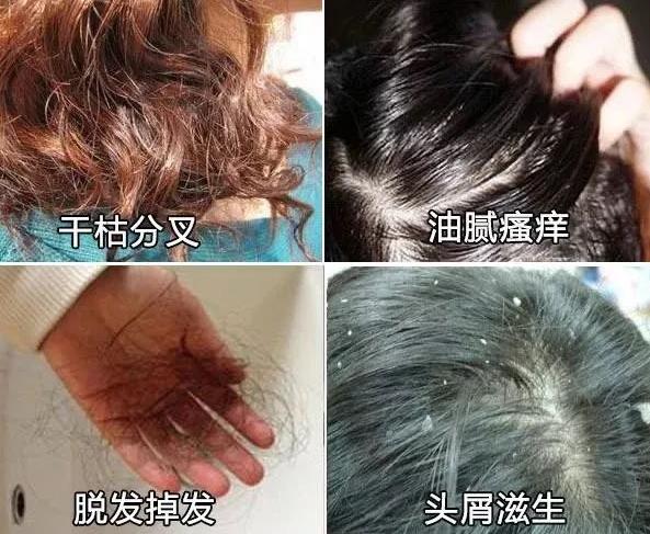 代替海飞丝洗发水,海飞丝洗发水和潘婷洗发水哪种好