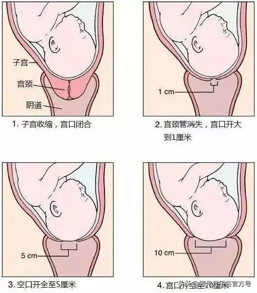 顺产必须开到十指才能用力么,顺产开十指是十级痛吗