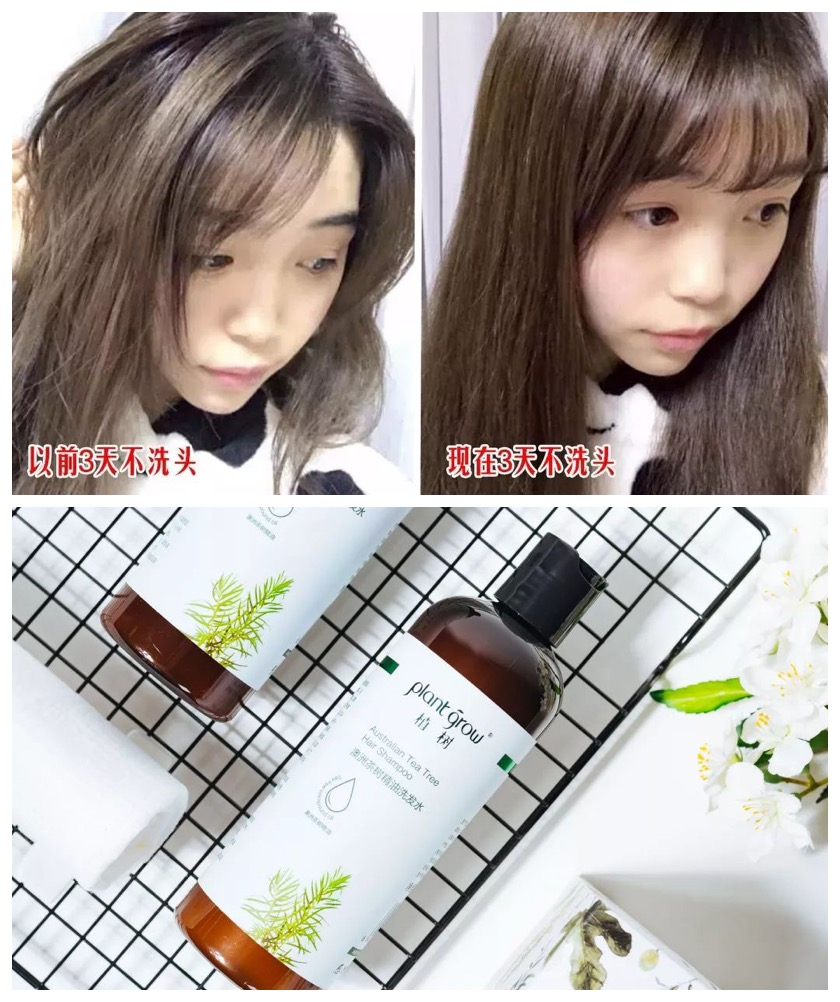 去头屑去螨虫哪个洗发水最有效,去头屑去螨虫用哪个洗发水最有效