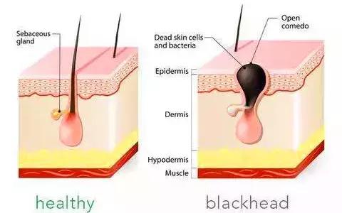 去黑头牙膏真实测评,牙膏去黄口测评