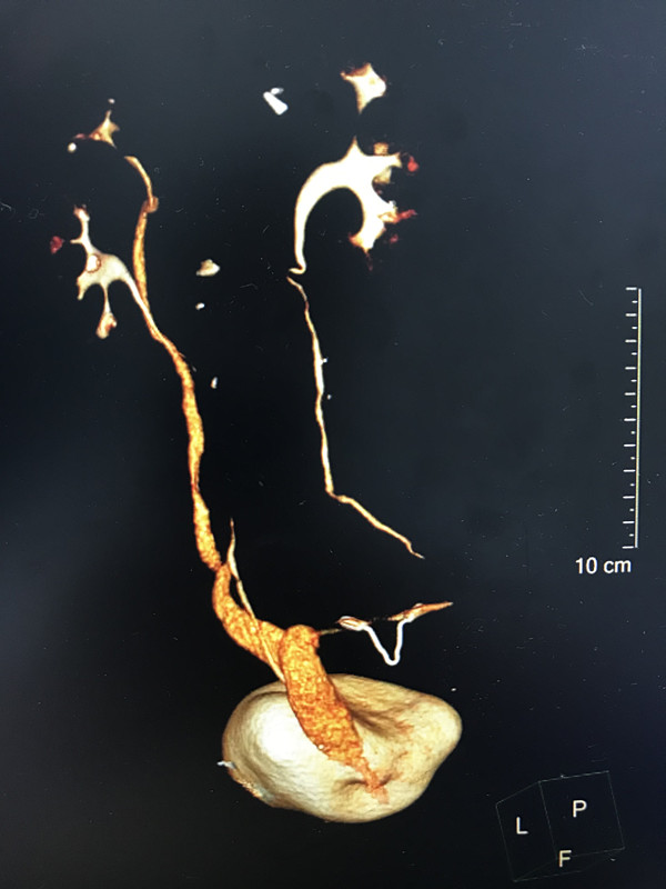 为这项先天缺陷尴尬了40年，专家只花3小时即予治愈