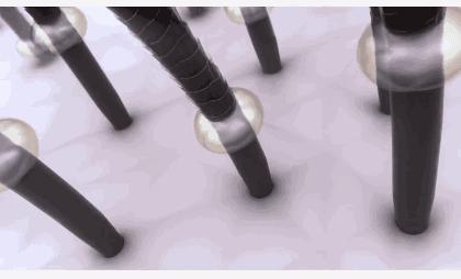 头发毛躁并且脱发推荐洗发水,用什么洗发水改善头皮脱发