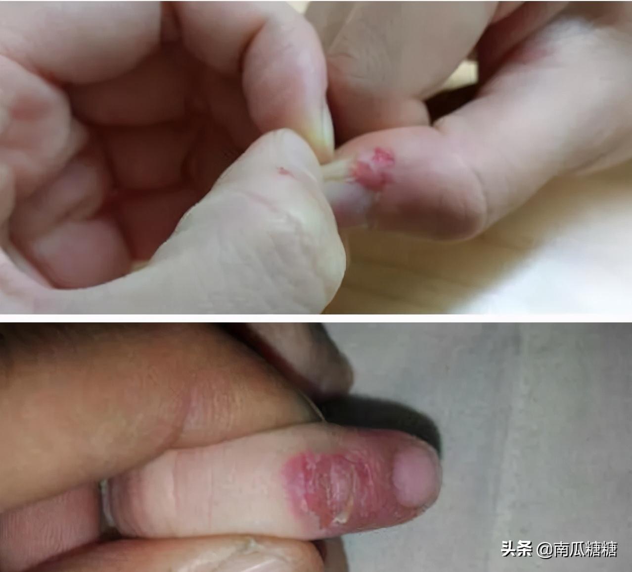 孩子抠指甲是缺什么,孩子抠手是缺什么维生素