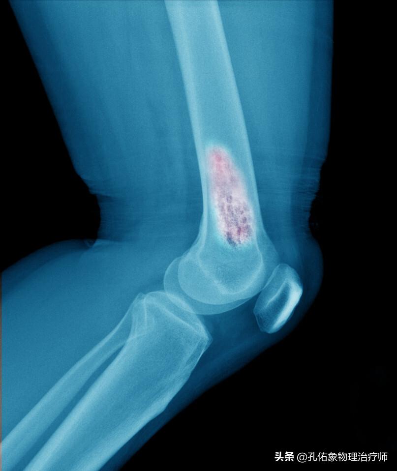 手指肿胀有硬硬的感觉,手指有结节有僵硬疼痛是什么病