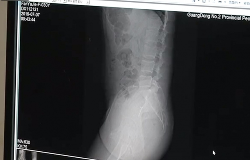 女子不慎从10楼坠落,女子不慎摔下