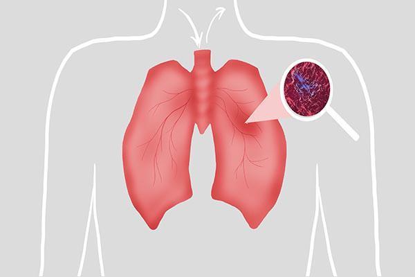 总是感觉后背疼痛酸胀是怎么回事,总感觉后背酸痛是怎么回事