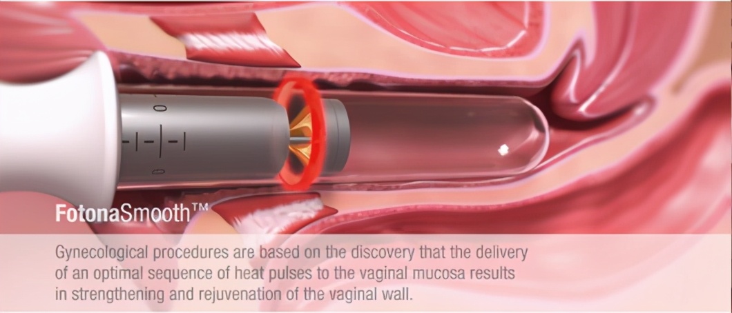 浜у悗瀹濆濡備綍鎭㈠鏉惧灝鍨殑鑲氱毊,瀹濆浜у悗鎭㈠绱ц嚧