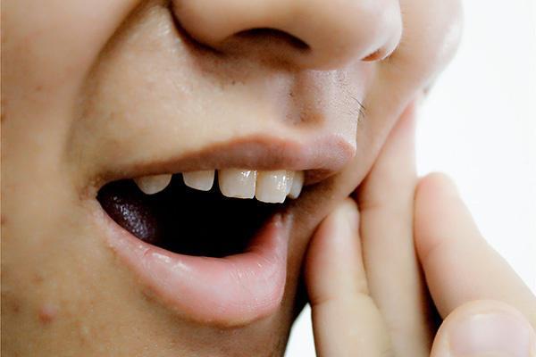 整牙堪比换头,整牙堪比整容真人案例