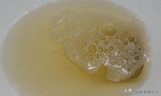 过度“用手”解决的男人，身体就会收到这些恶果，再不停手就惨了