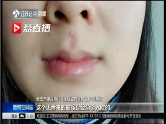 论挤痘痘,黑头去除方法挤痘痘