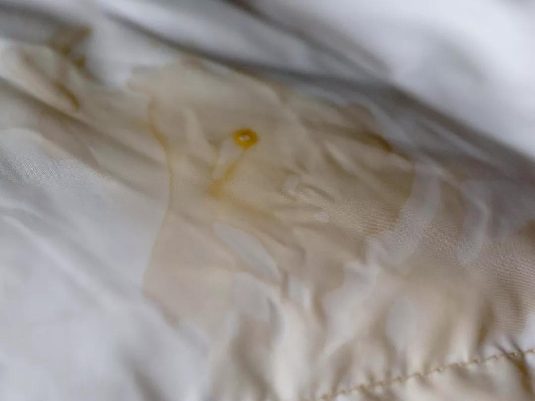 羽绒服脏了直接用毛巾擦可以吗,白色羽绒服特别脏干洗店能搞定吗