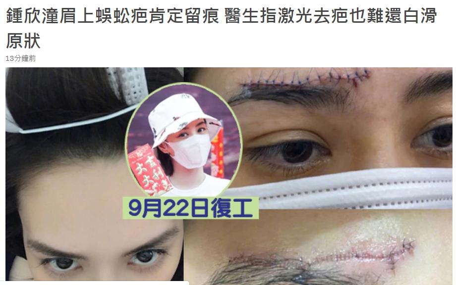 医美专家爆阿娇6㎝伤口肯定留疤痕,激光也难以恢复平滑肌肤