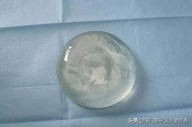 丰胸假体有哪些品牌好用,假体丰胸假体质量