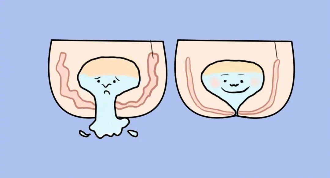 花1000普拉提培训,普拉提盆底肌怎么练