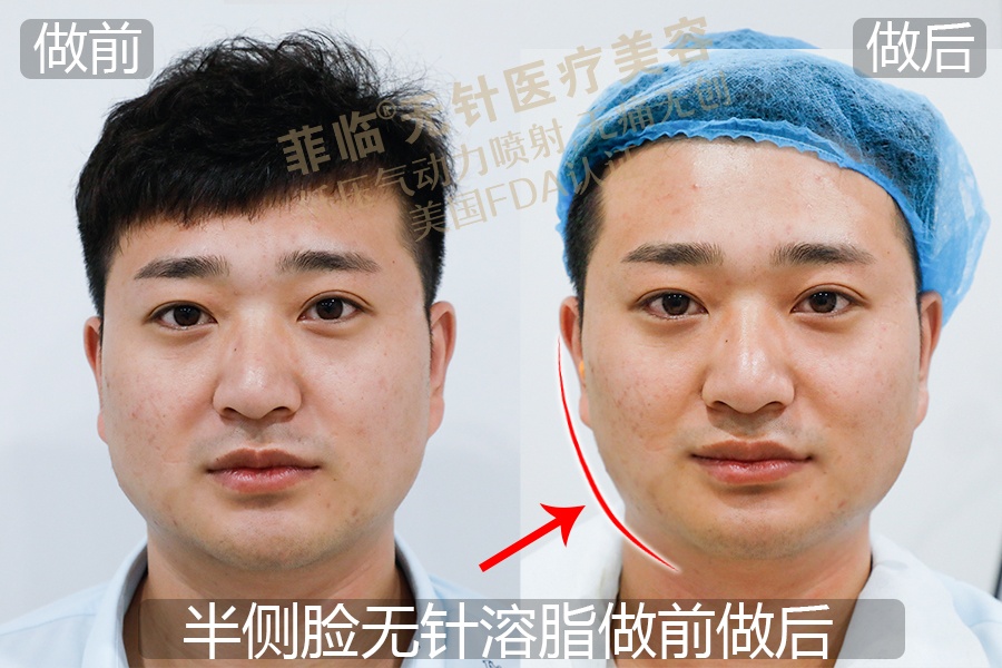 逆天侧颜女,逆天绝世容颜