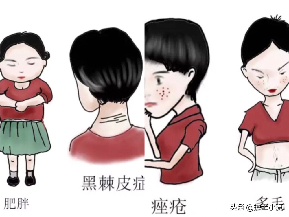 多囊卵巢综合征能怀孕不,多囊卵巢综合征能正常怀孕吗