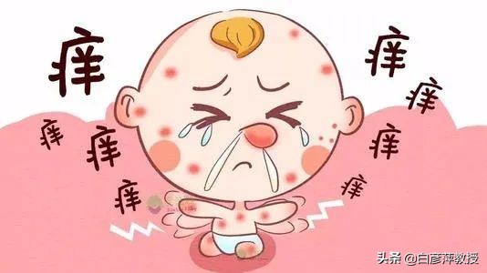 *麻疹荨**是啥病？哪些人容易患*麻疹荨**？这里给您解答