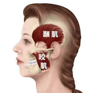 牙套脸怎么恢复原来脸型,整牙齿的牙套脸可以恢复吗