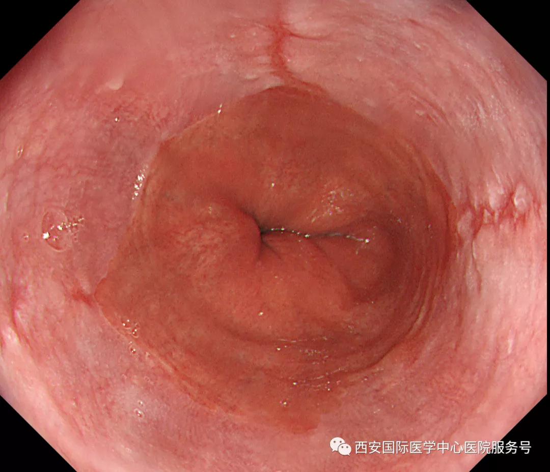 咳嗽不止很是难受,咳嗽不止容易犯呕