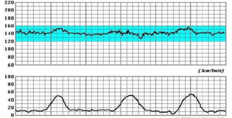 孕期最需要关注的指标,孕期关注甲状腺的哪些值