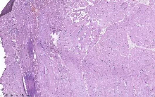 重度高碳酸血症突出表现,出现消化系统疾病的临床表现