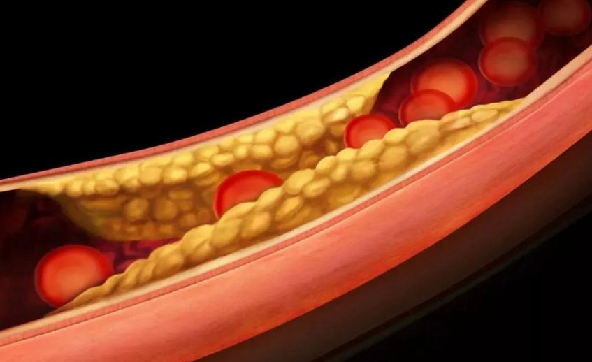 股骨头疼痛夜间明显是怎么回事,股骨头疼痛五个月能到什么程度