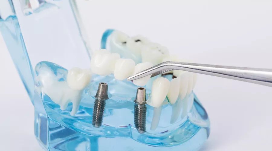 心脏核磁共振能做烤瓷牙吗,做核磁共振嘴里有金属牙能做吗