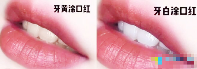冷光牙齿美白的方法有哪些,viva冷光和皓齿冷光美白的区别