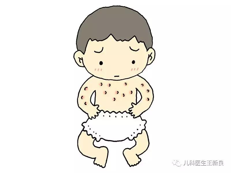 紫癜讲解,紫癜的介绍