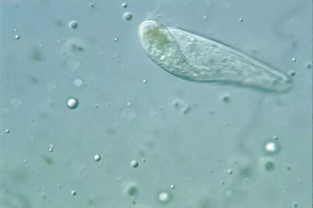 收藏!24种污水处理微生物菌相及指导意义,环保人必看(多图)