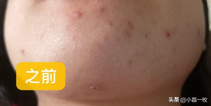 油性皮肤秋冬护肤步骤,油性皮肤护肤正确方法