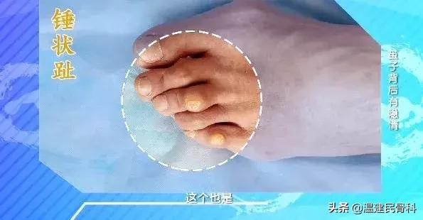 cctv2019年3月25日健康之路节目,cctv10健康之路4月1日回放