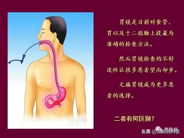 无痛胃镜注意事项和禁忌,做无痛胃镜的注意事项和危害