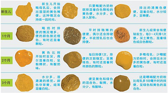 宝宝身体状况可以通过便便知道吗,宝宝的便便早知道