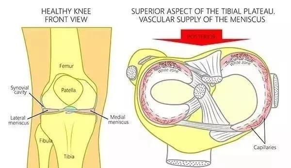 半月板损伤干细胞,半月板损伤干细胞注射液价格
