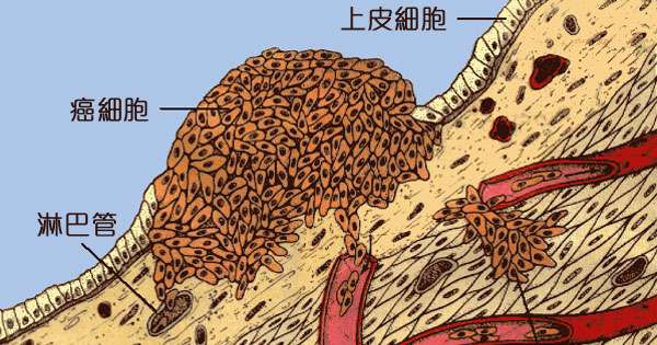 以色列治癌症几率多高,以色列癌症突破消息真假