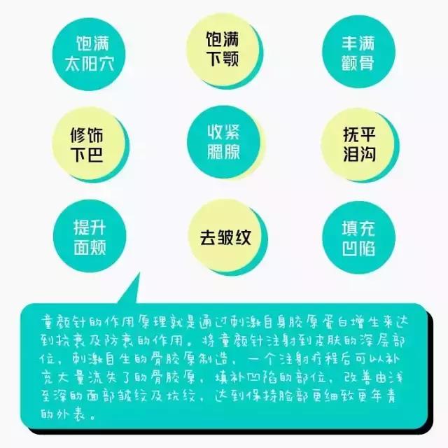 王菲打的童颜针啥牌子,王菲填充太阳穴童颜针